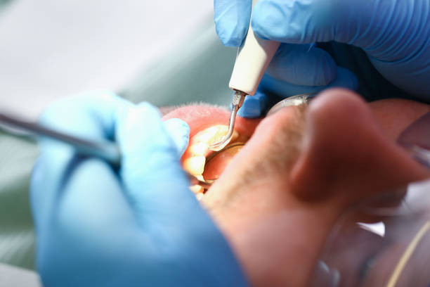Best Broken or Chipped Tooth Repair in North Bellmore, NY